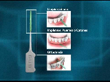 plus-conico.jpg_product_product_product_product_product_product_product_product_product_product_product_product_product_produc